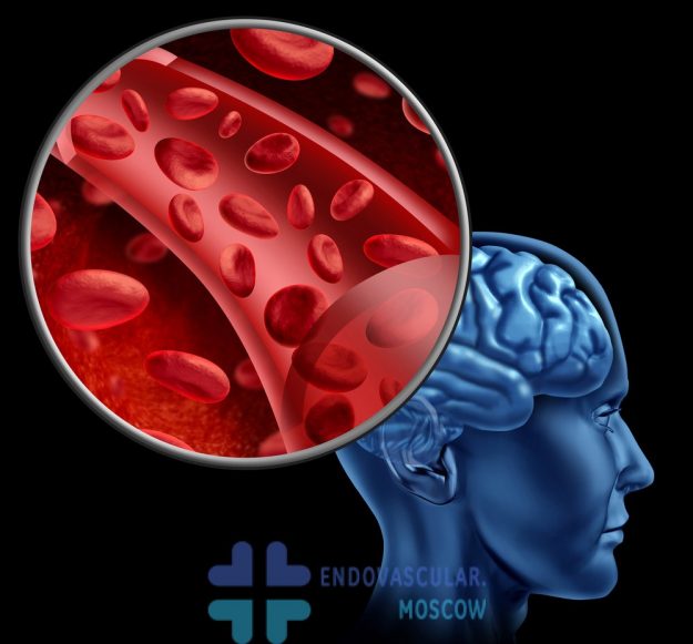 кровоснабжение-мозга